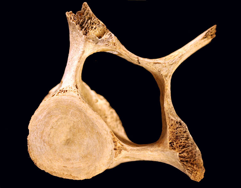 Image couleur d’un os brun